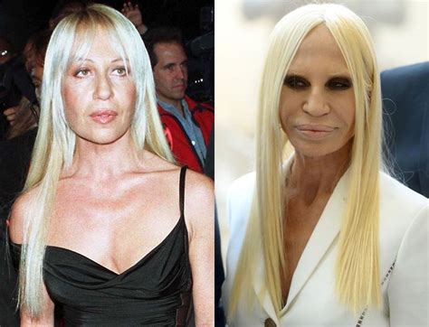 versace before and after plastic surgery|donatella Versace without make up.